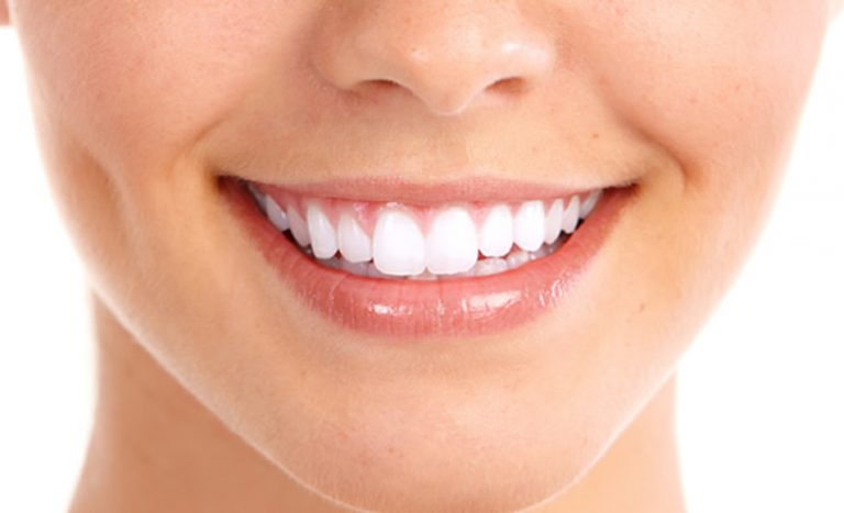 Clínica dental Chamberí Madrid injertos